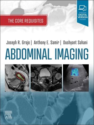 cover image of Abdominal Imaging